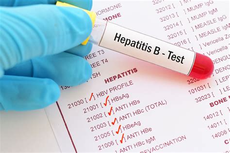 Hepatitis B Test .